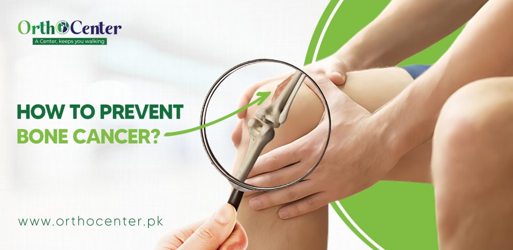 How to Prevent BONE CANCER