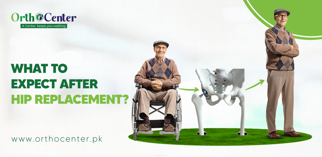 After Hip Replacement