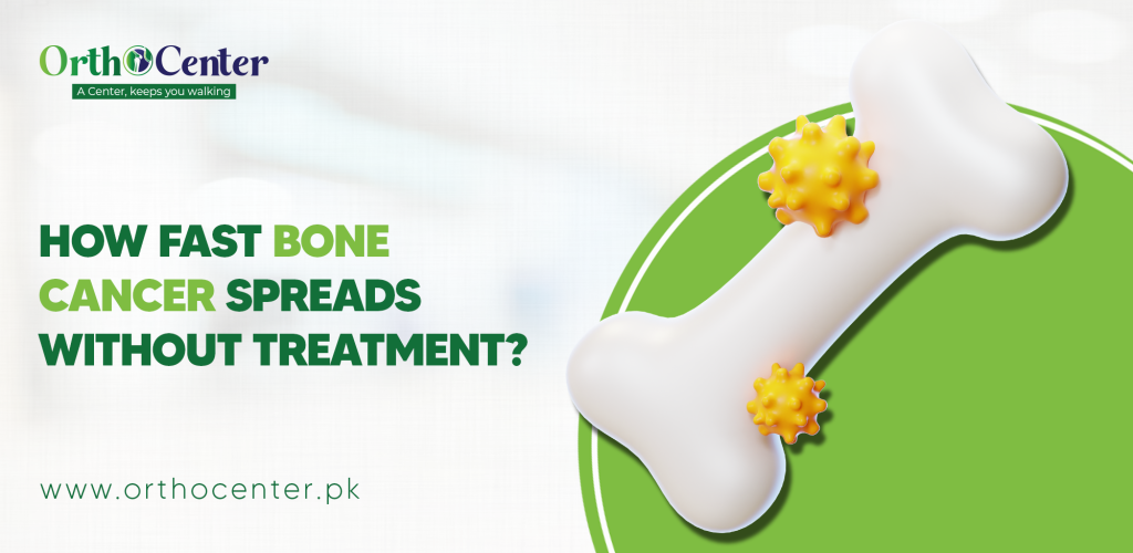 Bone cancer spreads