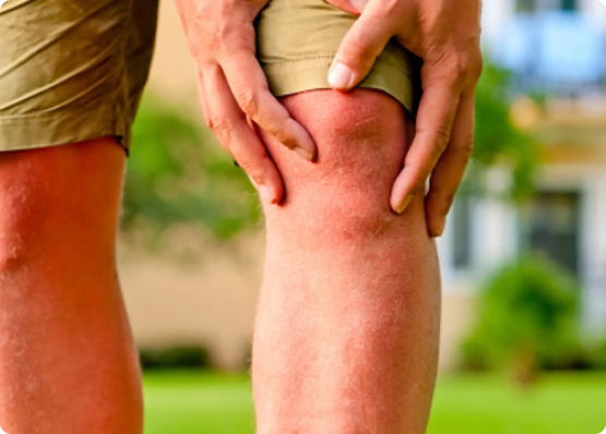 Causes of Knee Damage