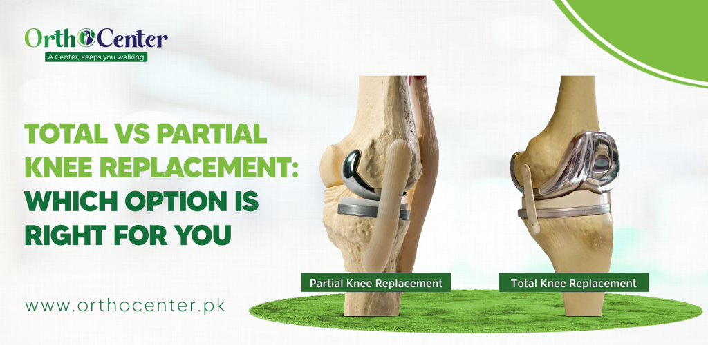 Total Vs. Partial Knee Replacement