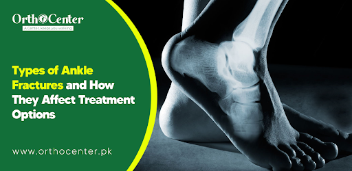 ankle fracture treatment