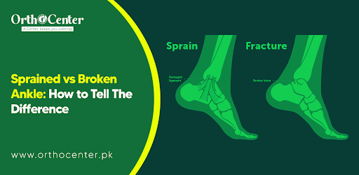 Sprained Vs Broken ankle