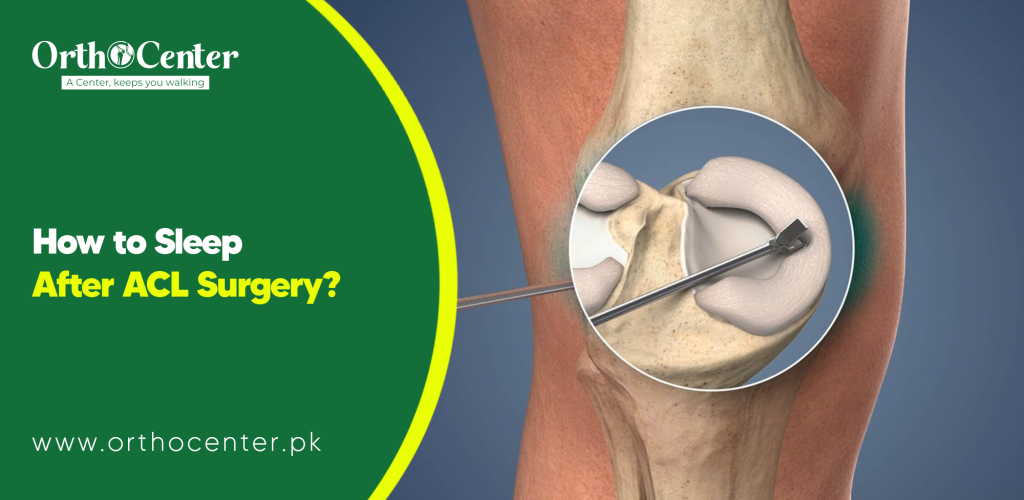 How to Sleep After ACL Surgery?